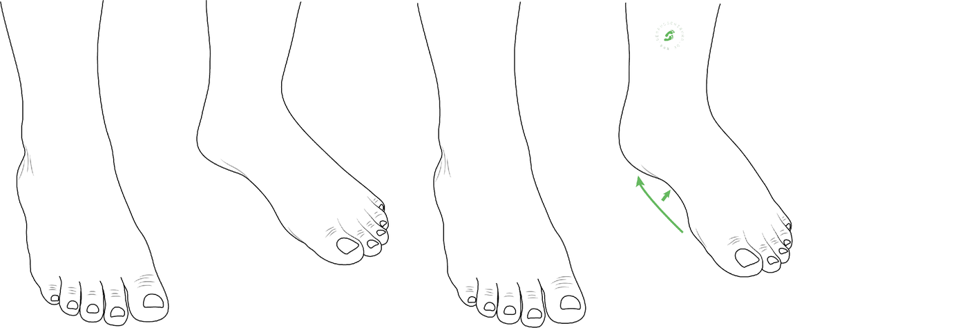 Build up and strengthen the arch of the foot with gymnastics